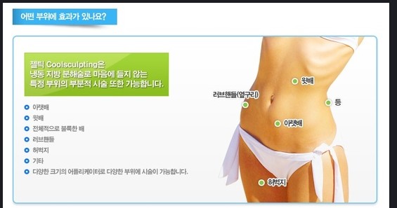 脂肪冷冻技术,冷冻脂肪减肥,非手术减肥,韩国减肥方法,韩国整形,韩国整形医院