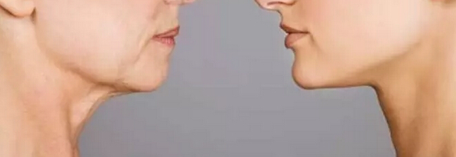 韩国整形,赴韩整形,年轻除皱,微整形除皱