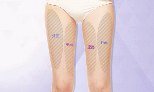 脂肪型腿部吸脂改善