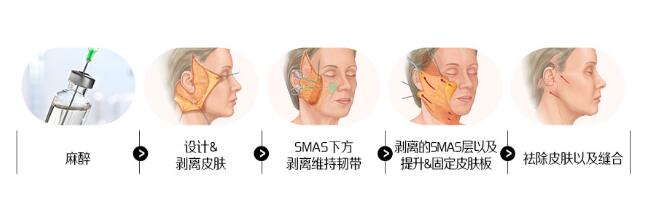 手术过程展示
