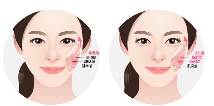 手术特点