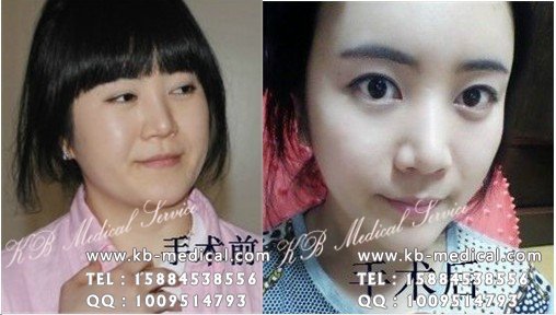 韩国整形,去韩国整形,韩国整形医院,赴韩整形,韩国整形专家