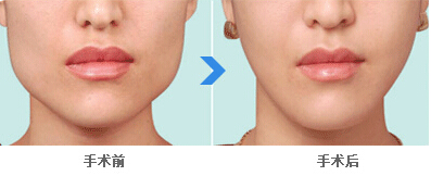 ķ,ķص,ķ,ķ,ҽԺ,,