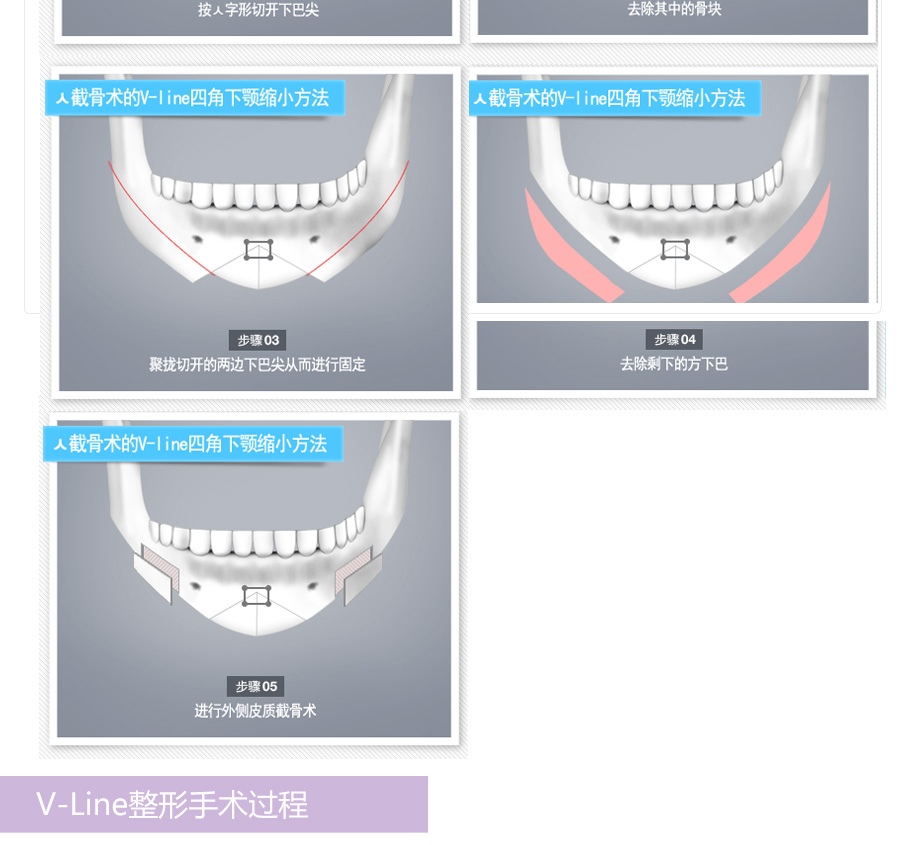 V-line,V-line,v-lineС,,沿