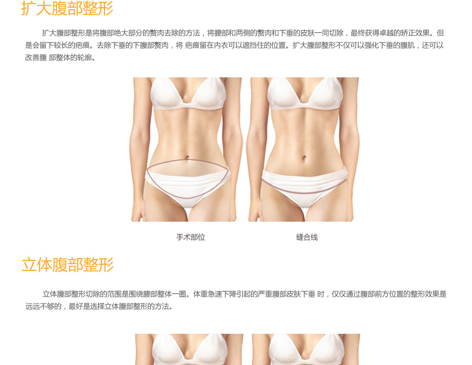 腹部吸脂术,腰腹部吸脂,腹部吸脂价格,腹部吸脂手术,韩国吸脂减肥