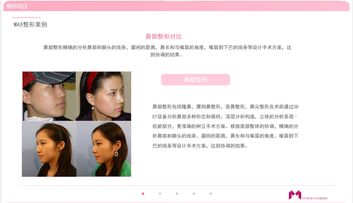 MAX整形医院对比案例