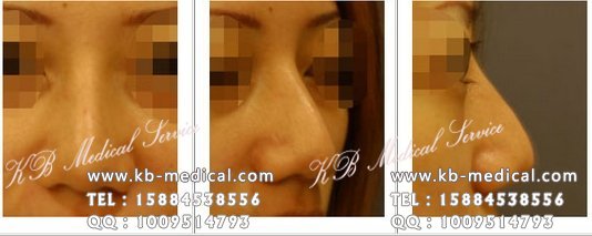 ,KB,,ר