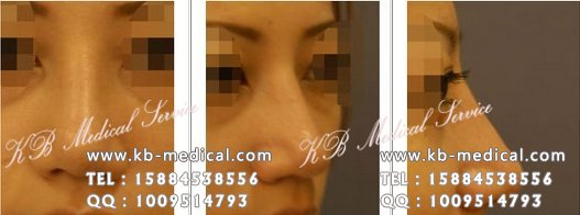 ,KB,,ר